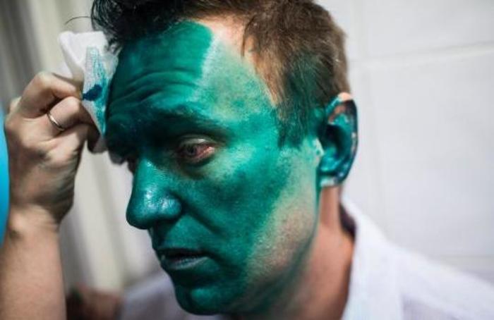 У Навального диагностировали "крапивницу"