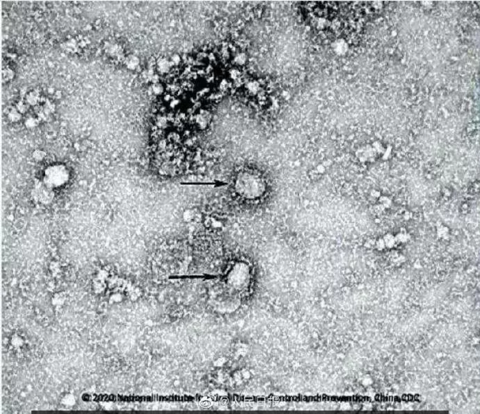 Число зараженных новым коронавирусом в Китае превысило 2 тыс человек