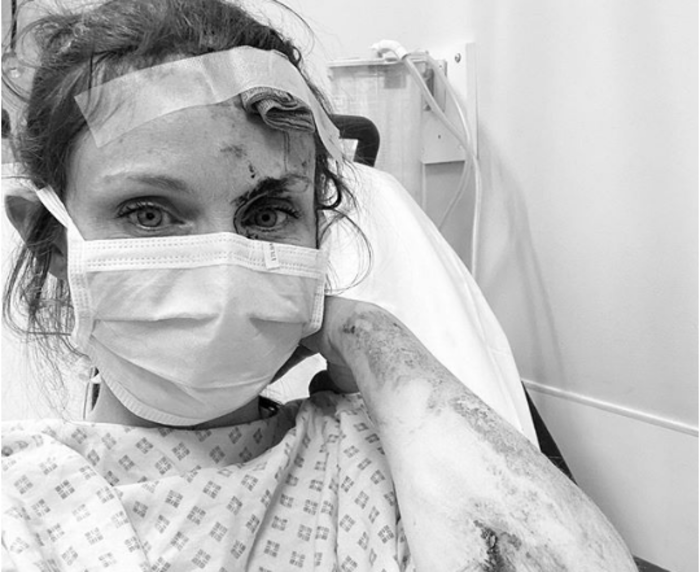 Певица Софи Эллис-Бекстор госпитализирована после падения с велосипеда