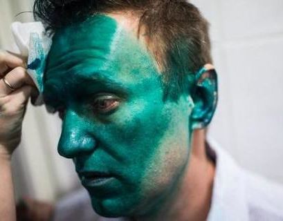 У Навального диагностировали "крапивницу"