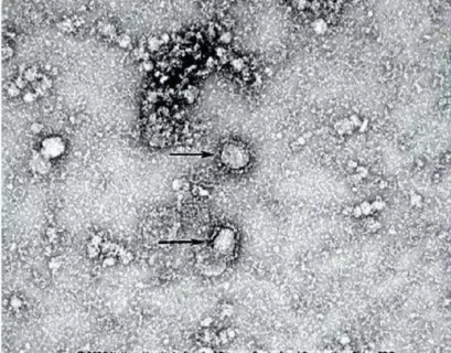 Число зараженных новым коронавирусом в Китае превысило 2 тыс человек