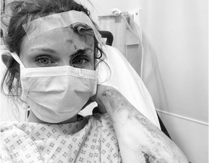 Певица Софи Эллис-Бекстор госпитализирована после падения с велосипеда